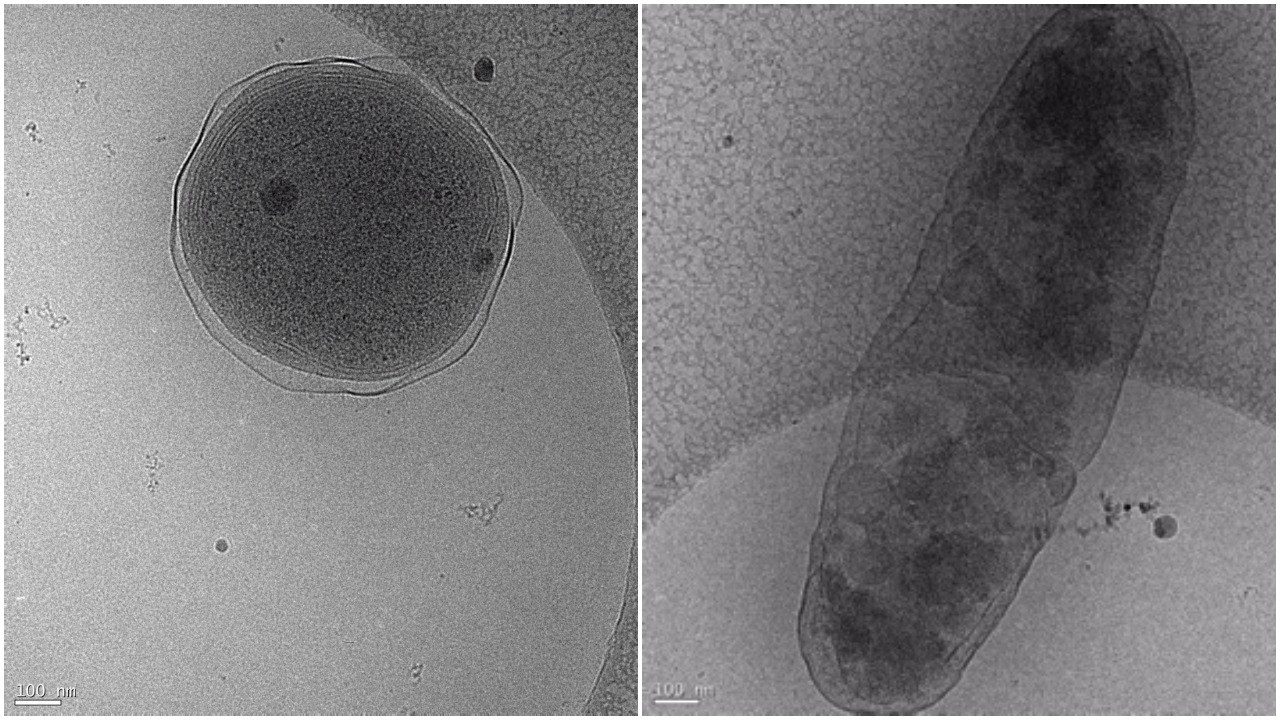 Cryo-electron microscopy images showing Prochlorococcus (left) and Alteromonas. The interaction between these two globally important microbes can be altered by ocean acidification. (Images: Terje Dokland, University of Alabama Birmingham). Cryo-electron microscopy images showing Prochlorococcus (left) and Alteromonas. The interaction between these two globally important microbes can be altered by ocean acidification. (Images: Terje Dokland, University of Alabama Birmingham).